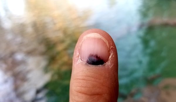 Fingernails 